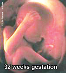 32 wks with caption for web